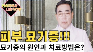 (4K)피부묘기증,묘기증의 원인?  묘기증의 치료방법? 묘기증과 음식,묘기증은 치료되나요?