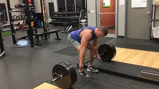 How to safely deadlift with lower back pain! Dead lift technique