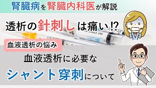 透析の針刺しはやっぱり痛い！？血液透析に必要なシャント穿刺について【腎臓内科医が解説】