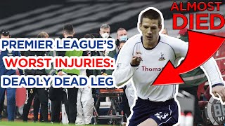 Premier League's WORST Unknown Injury of ALL TIME: Mystery *Deadly* Dead Leg | ( w/ Ben Dinnery)