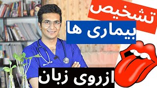 Diagnosis of the disease | از روی زبانتان بفهمید چه بیماری‌ دارید