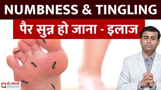 NUMBNESS & TINGLING पैर सुन्न हो जाना - इलाज numbness in hands and feet #numbness