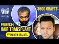 Hair Transplant Testimonial | Most trusted hair transplant clinic in India, Delhi | Medlinks