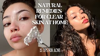 HOW TO MAINTAIN CLEAR SKIN WITHOUT SPENDING MONEY | 15 tips and tricks for acne