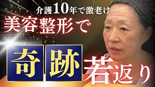 【50代60代向け】糸リフトのリアルな経過を公開します