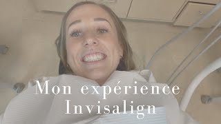 Mon expérience Invisalign - Le Petit Quotidien de Camille