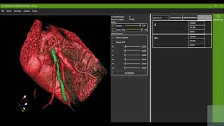 SMARTool CDSS technical overview