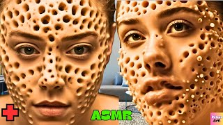 ASMR ANIMATION 😲😒 | REMOVE TRYPOPHOBIA, DOG TICKS FROM INFECTED FACE | ASMR TREATMENT