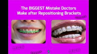 The BIGGEST Mistake Doctors make after Repositioning Brackets with Power Chain and Ligature Ties