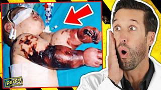ER Doctor REACTS to World's Deadliest Diseases #5