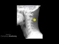 Osteopath Skills - How To Scan a Patient's C Spine Xray