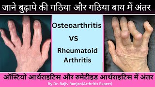 Osteoarthritis vs Rheumatoid Arthritis | बुढ़ापे की गठिया और गठिया बाय में अंतर