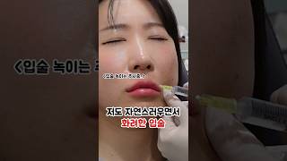 3년된 유행지난 입술필러 싹 다 녹이기 #필러녹이기