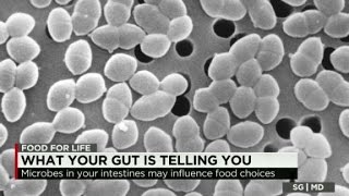 Sanjay Gupta MD: Gut microbes may influence food choices