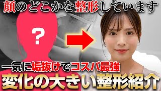 顔の印象を決めるのは目だけじゃない！整形で印象がガラッと変わるお顔のパーツを紹介します