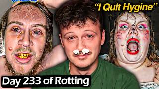 The TikToker Who Refuses To Shower Is ROTTING... | SICKENING!