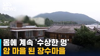 몸에 계속 '수상한 멍'…암 마을 된 유명 장수마을 / SBS