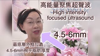 HiFu 無痛安全有效、做足三層深度夠完美！