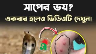 বর্ষা মৌসুমে বাংলাদেশে বাড়ে সাপ দংশনের প্রবনতা!