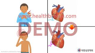 [시연용] b0005aako_[대한심장학회] 운동부하 심전도검사 안내