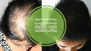 വെറും 2 ആഴ്ച...  ആണുങ്ങൾക്കും പെണ്ണുങ്ങൾക്കും ഒരേപോലെ ഉപയോഗിക്കാം.