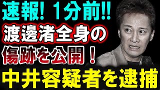 【芸能界激震】1分前！渡邊渚が全身の傷跡を公開！中井容疑者逮捕の衝撃的瞬間！