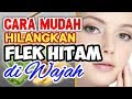 Cara Menghilangkan Flek Hitam