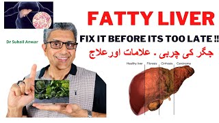 Fatty liver- a serious risk to health! Fix it with these powerful foods!. Dr Suhail Anwar.In Urdu