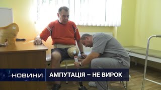 У Хмельницькому абсолютно безкоштовно, за показами, ставлять протези. 10.08.2021