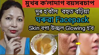 Skin বগা উজ্বল Glowing হ'বলৈ বেচনৰ লগত এই কেইটা বস্তু মিলাই facepack বনাই মুখত লগাব | vlog