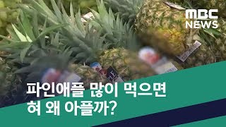 [스마트 리빙] 파인애플 많이 먹으면 혀 왜 아플까? (2019.05.18/뉴스투데이/MBC)