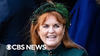 Sarah Ferguson, the Duchess of York, diagnosed with skin cancer