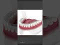 kaip „invisalign aligners“ padeda tiesinti dantis