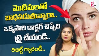 How To Remove Pimples Overnight || Pearl Beauty || Cosmetologist Naga Lakshmi || Sumantv