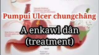 Pumpui ulcer chungchâng leh a enkawl dân.