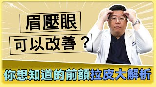 前額拉皮可以改善眉壓眼? 你想知道的前額拉皮完整解析! ｜林敬鈞醫師｜巨星整形外科