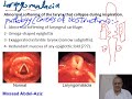 larynx 2 mosaad abdel aziz congenital traumatic u0026 inflammatory diseases of the larynx