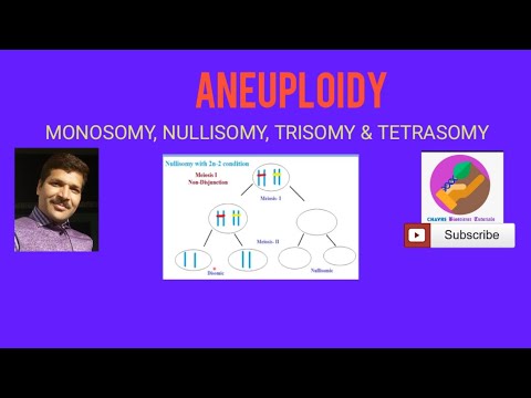 Which is an example of Monosomy?