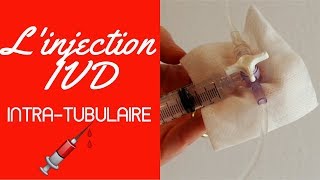 Injection IVD intra tubulaire