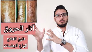 احدث الطرق لعلاج اثار الحروق بالتجميل / تقنيه حقن الدهون واقتطاف الجلد