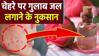 चेहरे पर गुलाब जल लगाने से क्या होता है | Chehre Par Gulab Jal Lagane Ke Nuksan | Boldsky