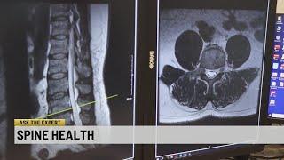 Ask the Expert: Spine health