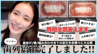 【34歳】大人の歯列矯正でブラオフした３児母が気になること全て話してみた【超赤裸々】