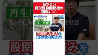 変形性股関節症の原因とは？専門医が短く分かりやすく解説! #shorts