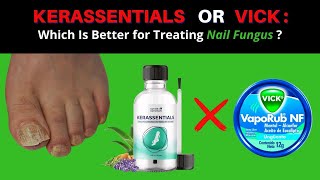 Does Vicks VapoRub or Kerassentials: Really Work for Toenail Fungus?