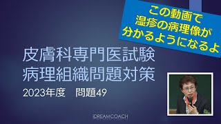 皮膚科専門医試験病理問題の解説　2023年度問題49