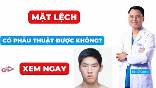 Phẫu Thuật Sửa Mặt Lệch: Lựa Chọn Để Cải Thiện Ngoại Hình | Bác sĩ Cường