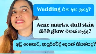 වාසි ගොඩාක් තියෙන මගේ oil එක ❤️ |Saffron oil |Glowing skin |self love #sinhala #bhagya #selfcaretips