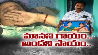 తండికొండ వ్యాన్ బోల్తా పడిన విషాద ఘటనకు ఏడాది పూర్తి | Victims not Received Compensation