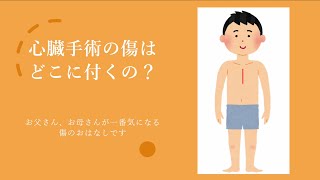 心臓手術ってどこに傷が付くの？